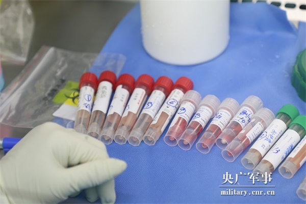 带你一探究竟新冠病毒核酸检测流程是什么样的？